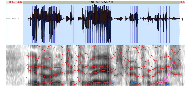 Uppity Women Addendum – The Vocal Fries Pod